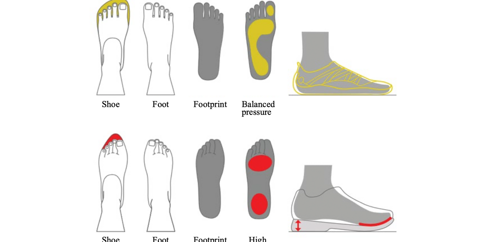 Feet and Footwear: Applying Biological Design and Mismatch