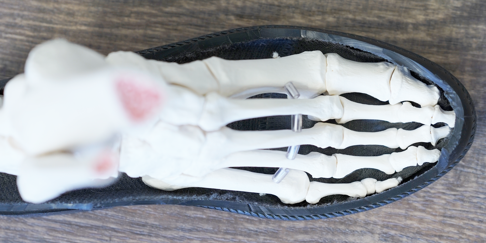 Improving big toe alignment