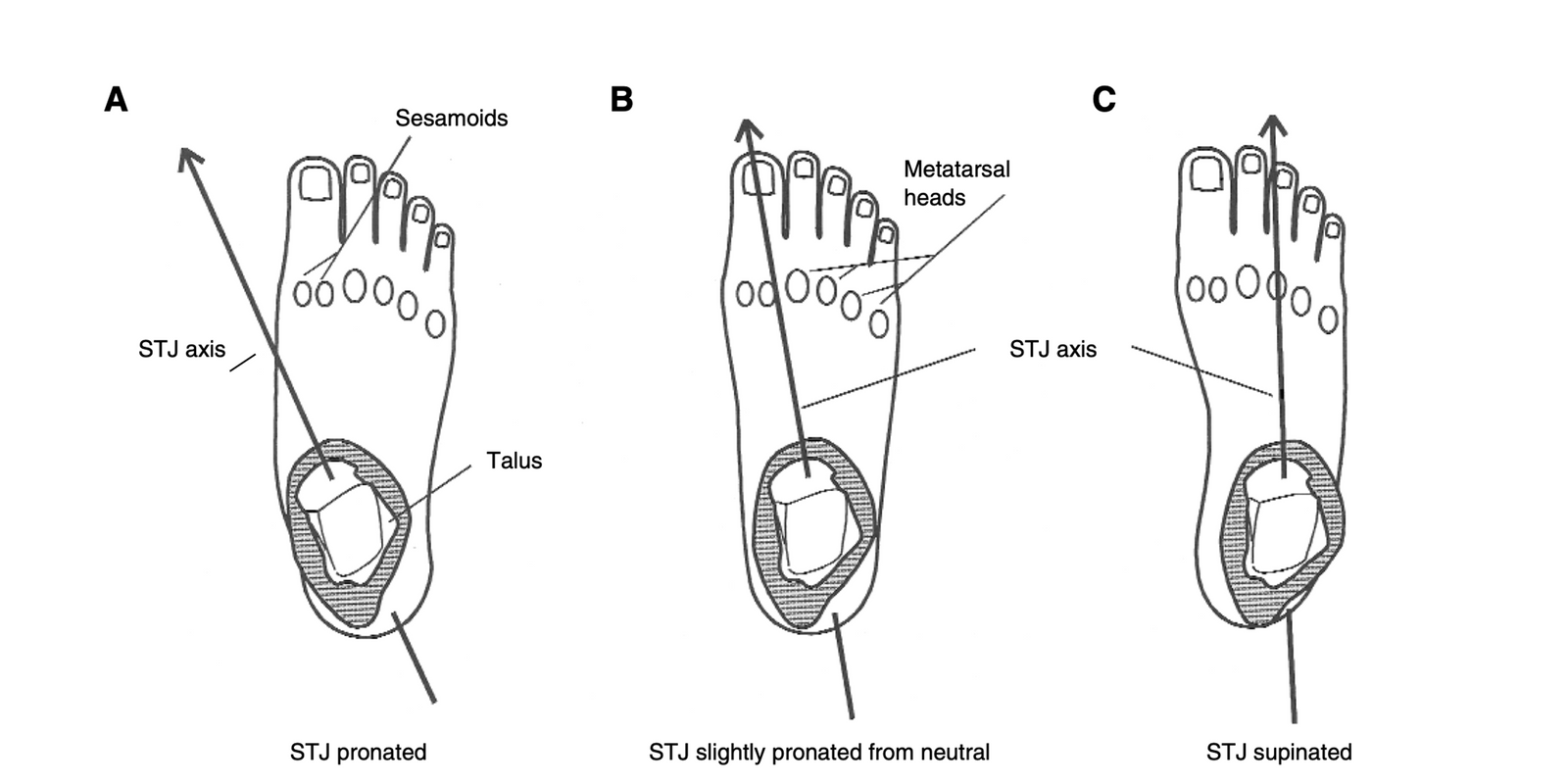 Subtalar Joint Axis Location and Rotational