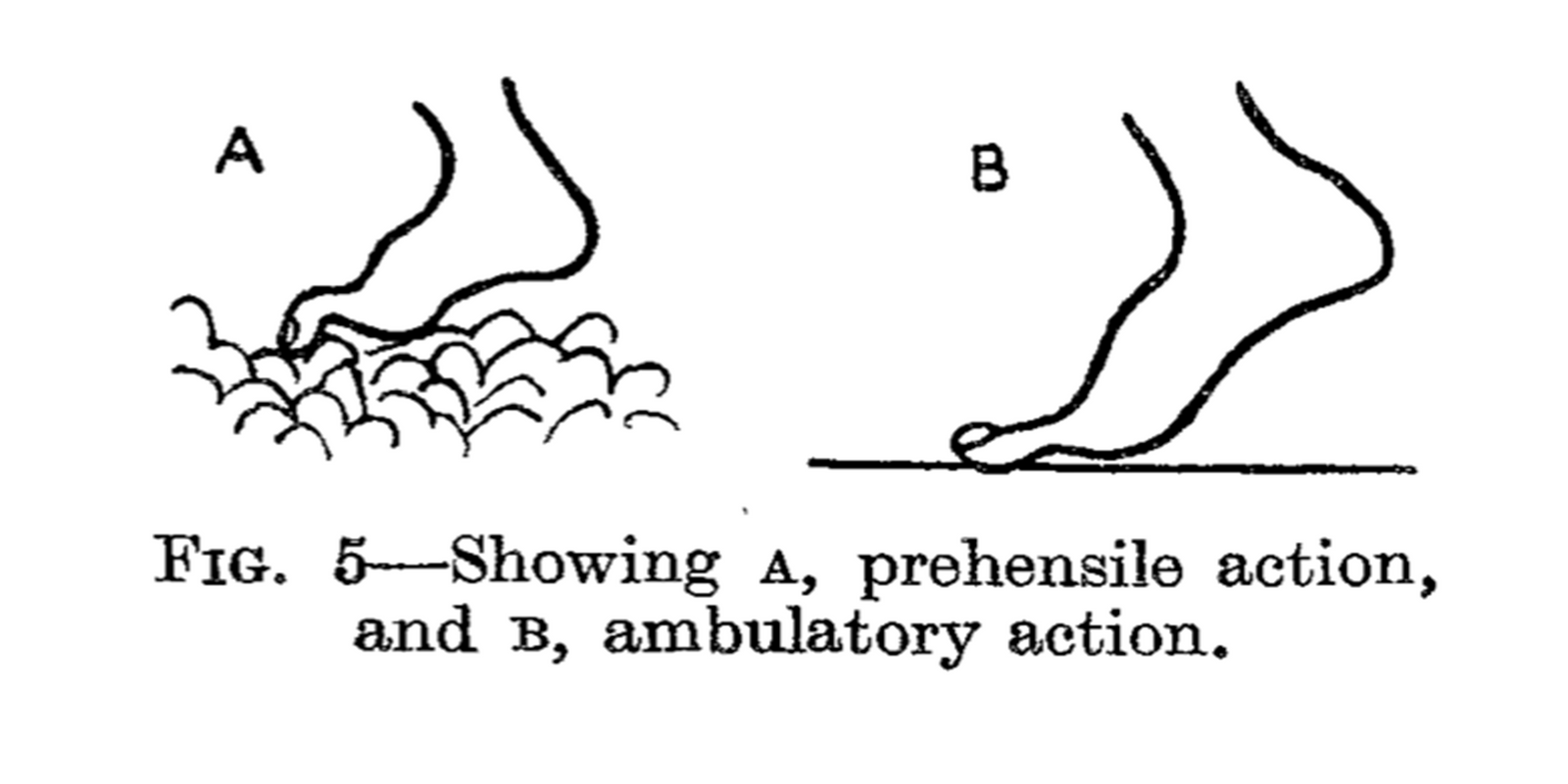 The feet of the industrial worker - E. P. CATHCART, M.D