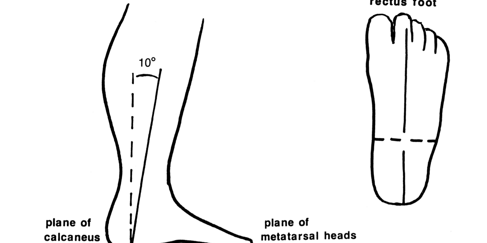 Pathomechanics of Structural Foot Deformities