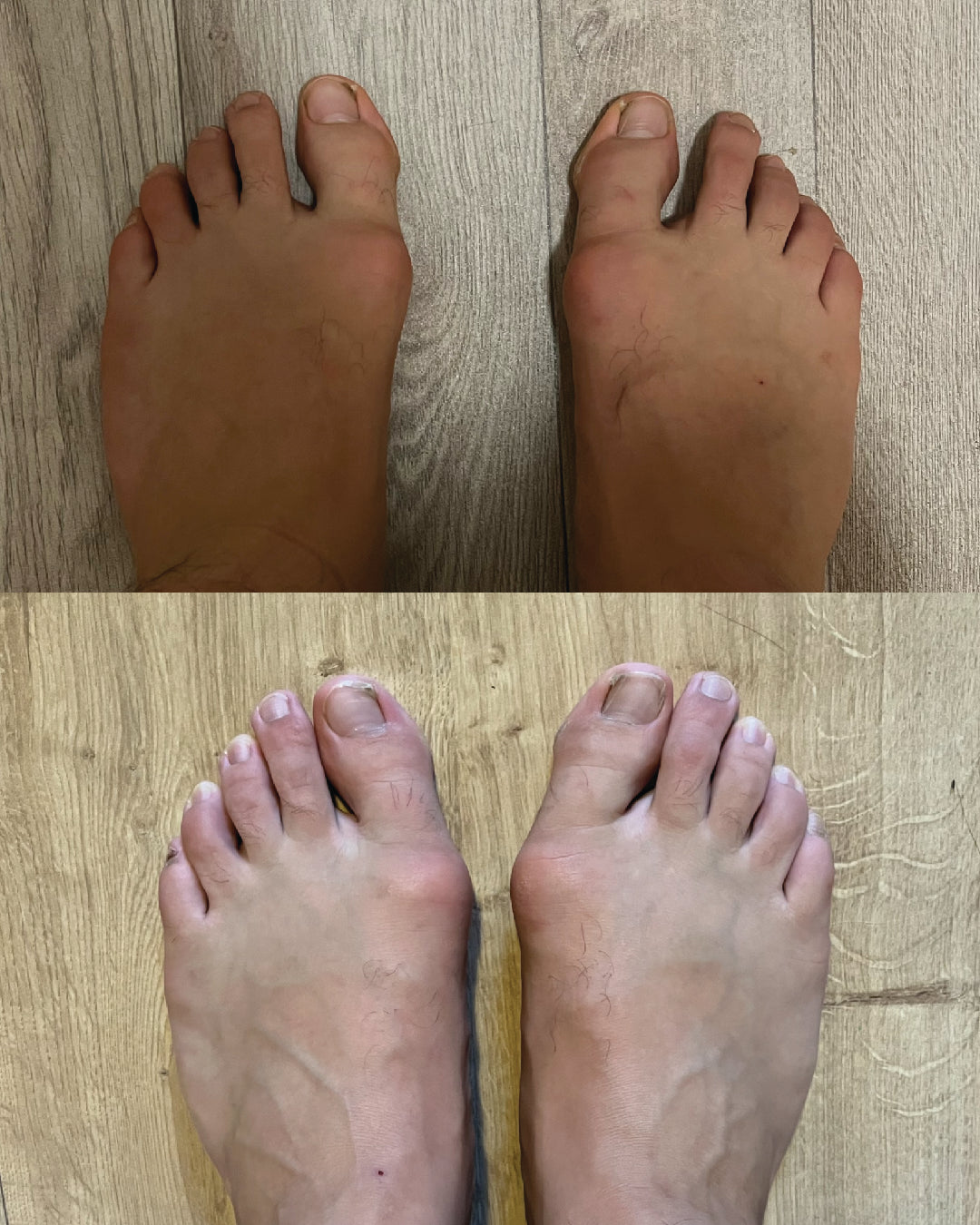 Top 4 Essential Exercises